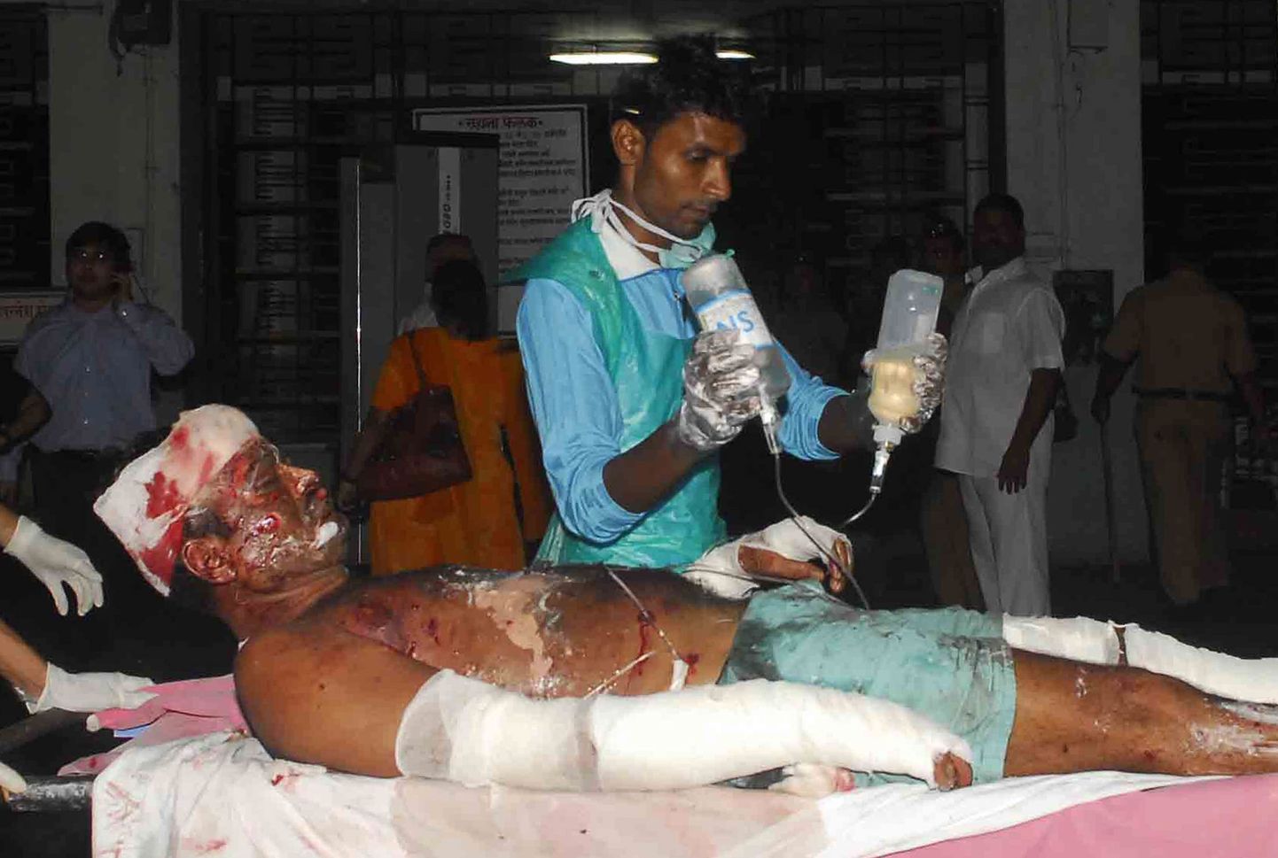 Мужчина, пострадавший в Мумбаи от взрыва