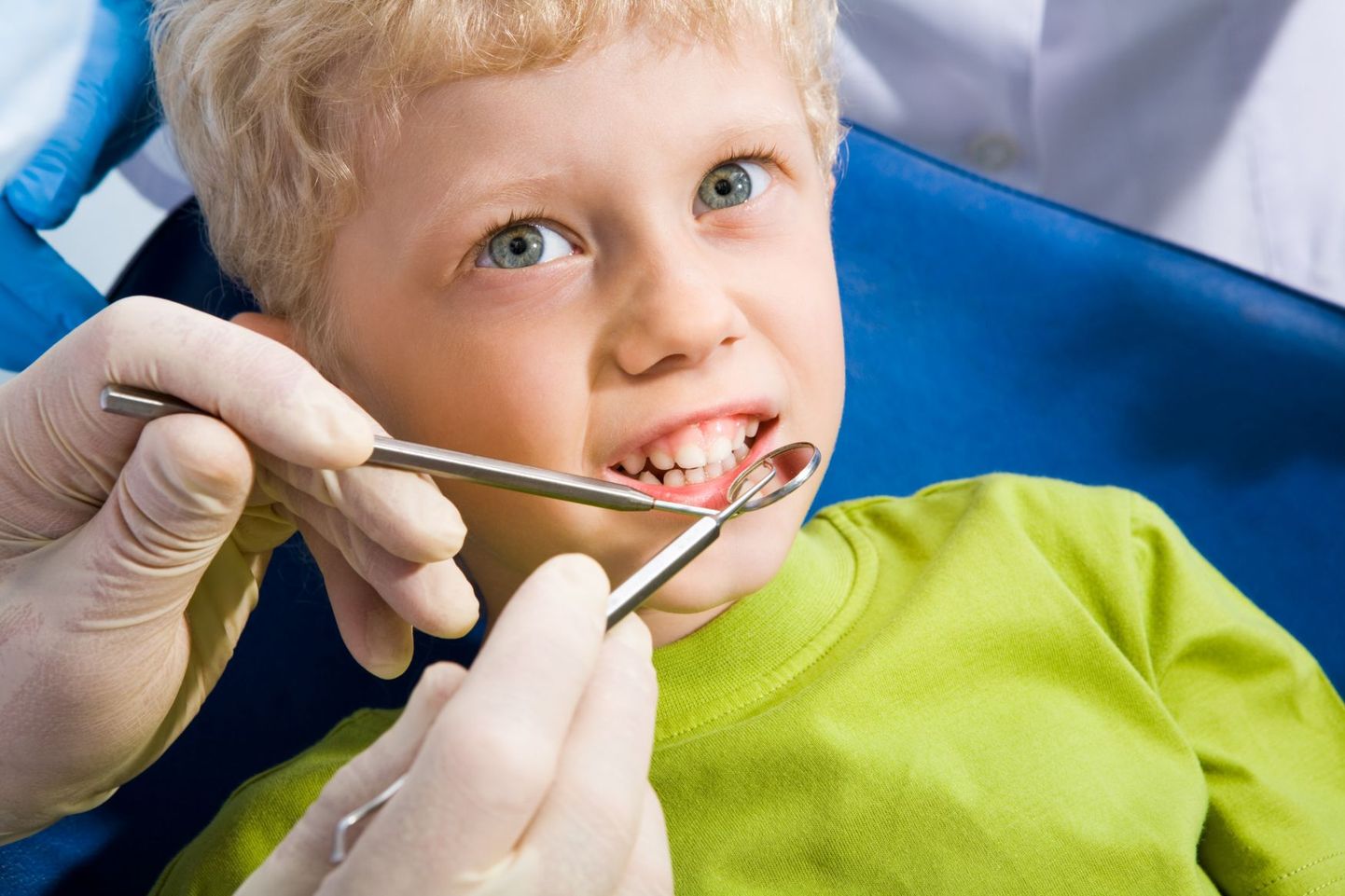 Halb suuhügieen võib viia hambaaukude tekkimiseni.