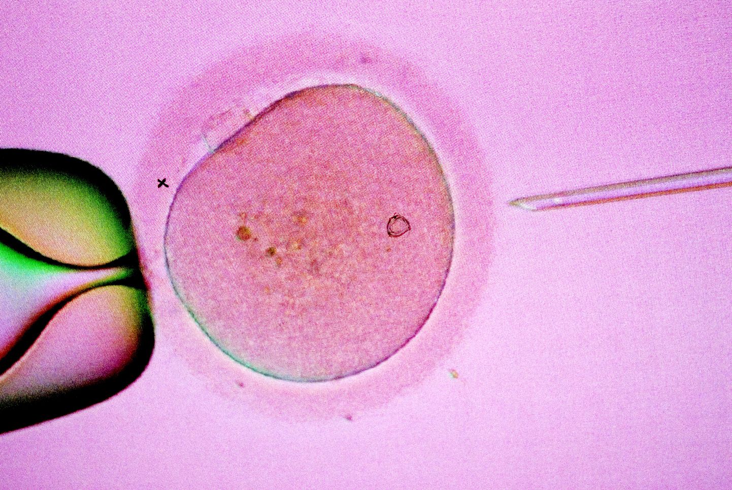 Kehavälise viljastamise (IVF, in vitro fertilisation) protseduur.