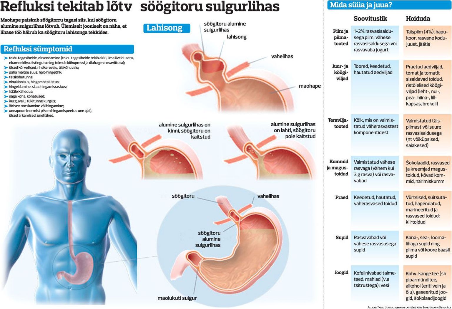 Refluksi tekitab lõtv söögitoru sulgurlihas.