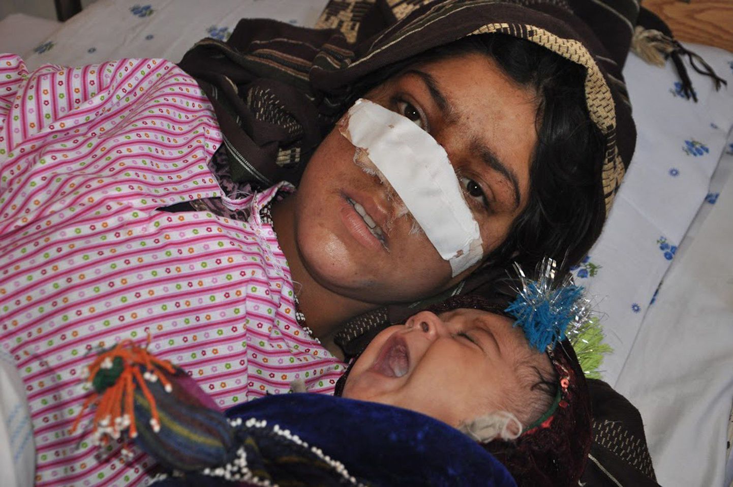 Afgaani naine Reza Gul, kellel tema abikaasa nina maha lõikas ja tema aastane laps haiglavoodis. Foto on tehtud 19. jaanuaril.