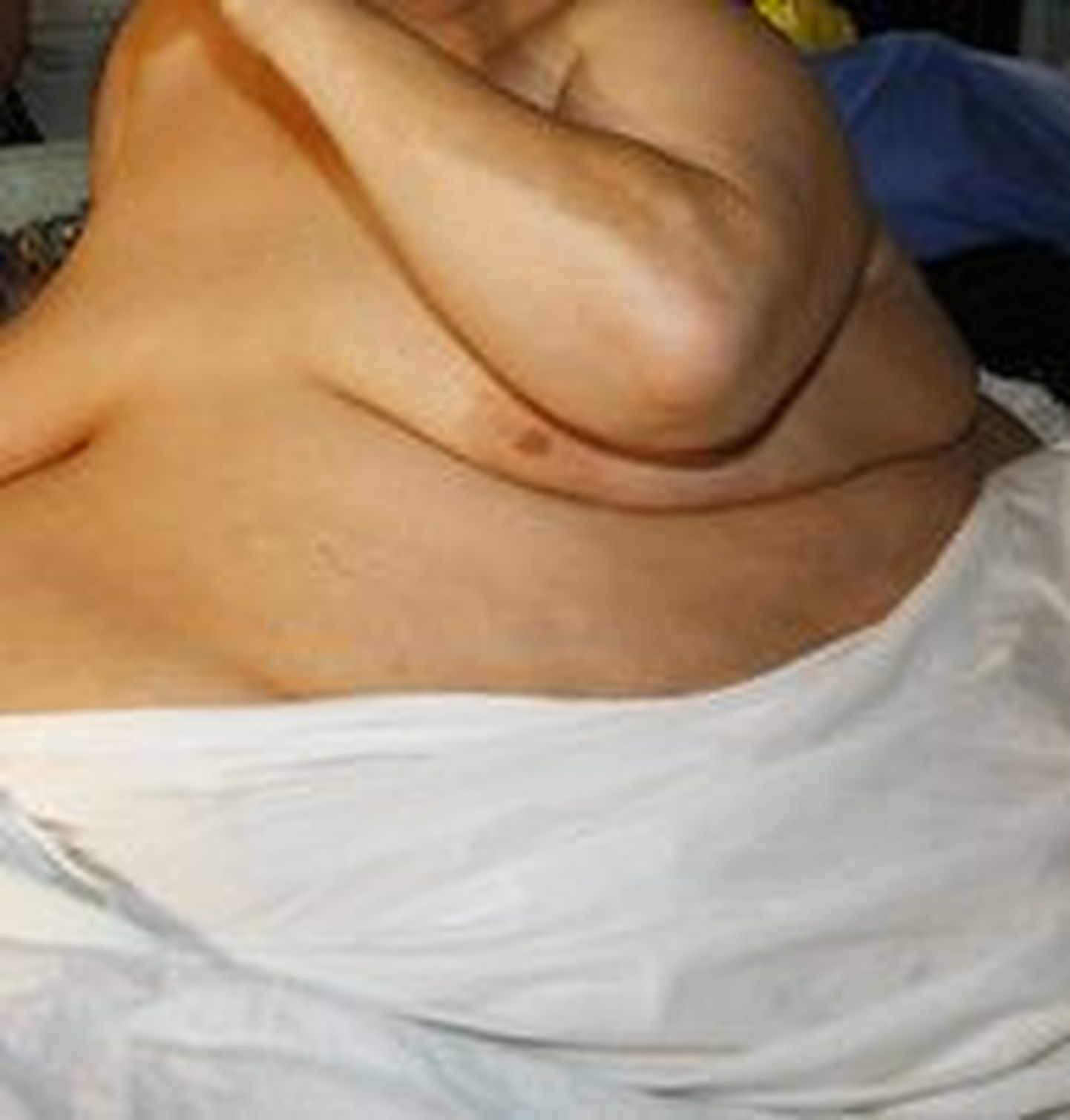 Mees kaotas kolme aastaga kehakaalust185 kilogrammi