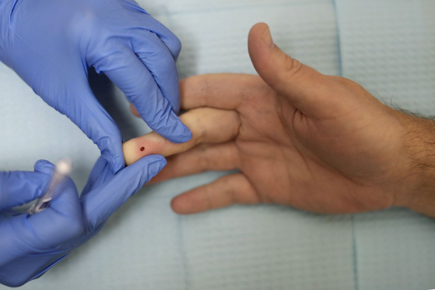 Vereproovi võtmine HIV-testi tegemiseks.