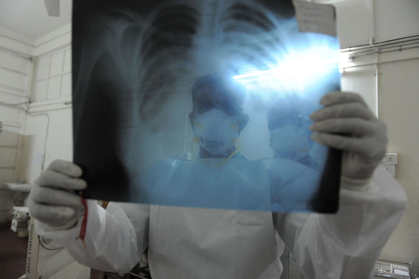 Seagripi viirusesse nakatunu röntgenpilt 12. märtsil 2013 Indias.