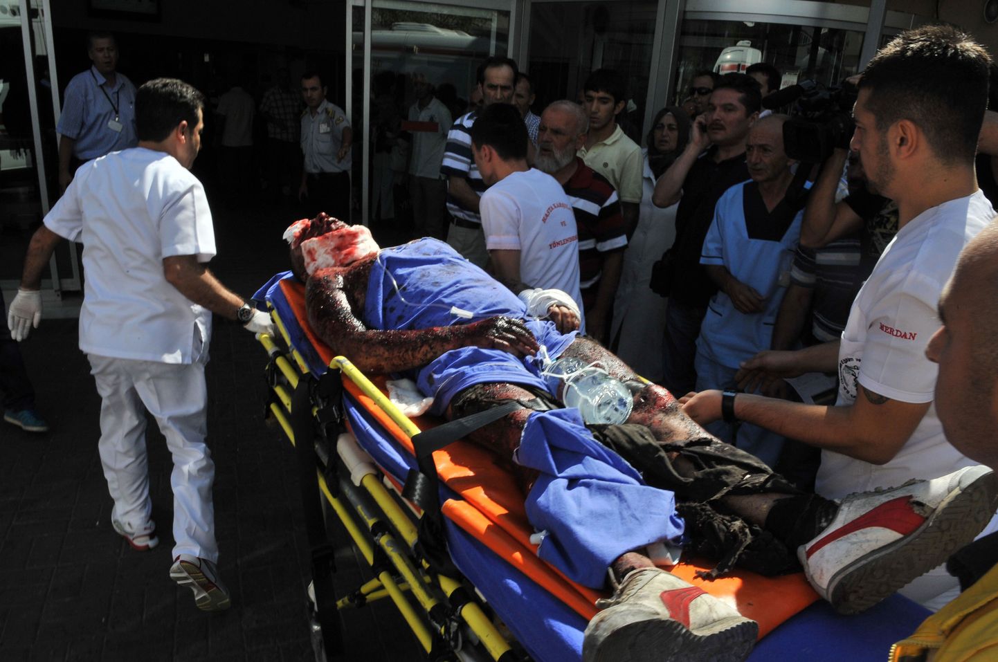 Kiirabitöötajad toimetavad autosse Istanbuli plahvatuses haavata saanud politseinikku.