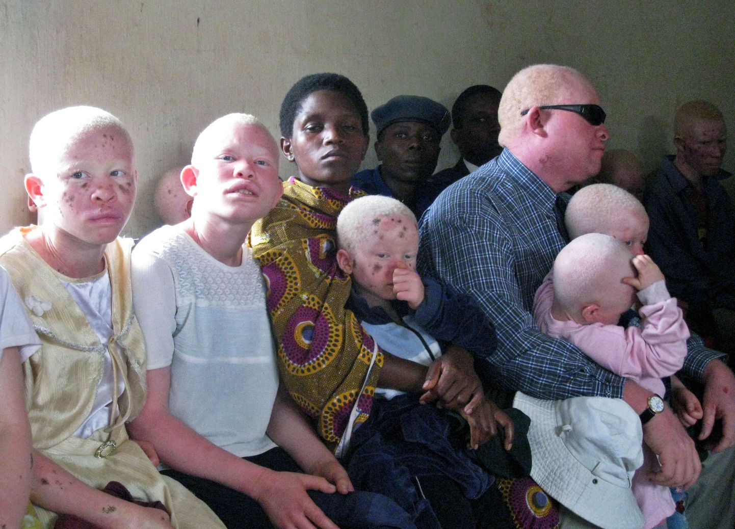 Tansaania sai esimese albiinost parlamendisaadiku. Fotol perekond, kus isa ja lapsed on albiinod