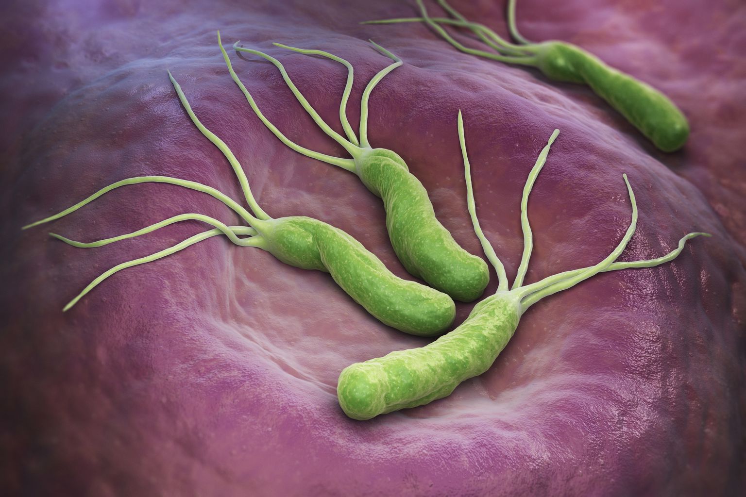 Helicobacter pylori