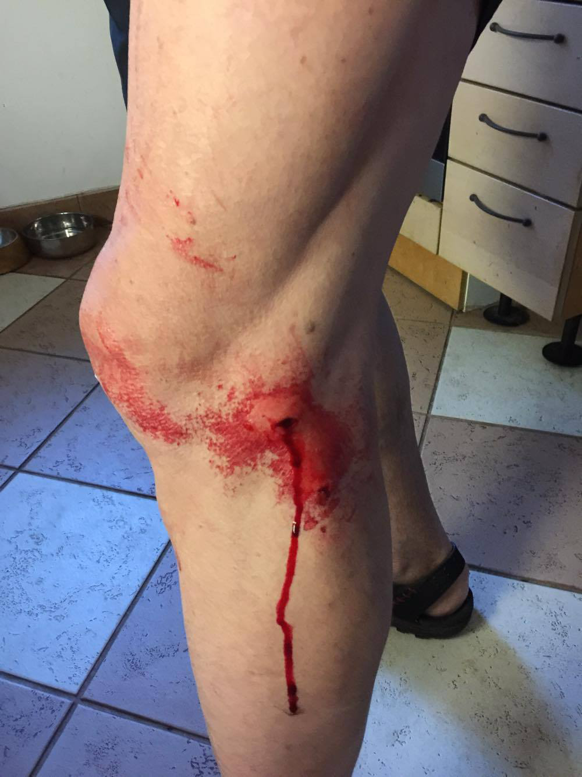 Агрессивная собака в Пирита напала на велосипедиста.