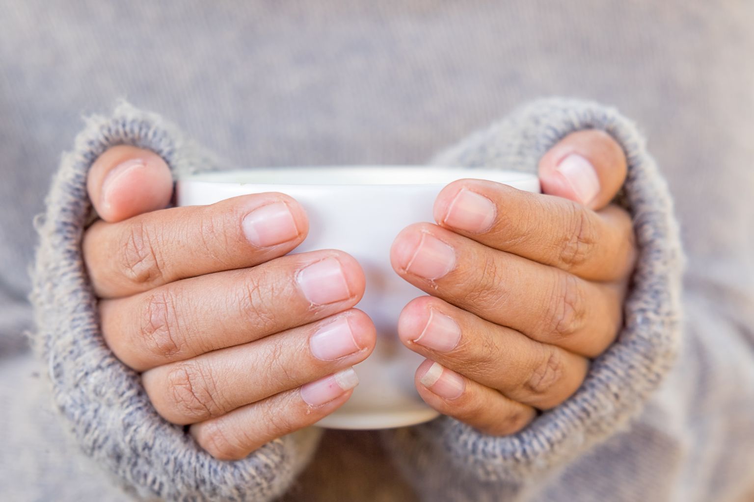 Pidevalt külmad käed võivad viitada mitmetele haigustele.