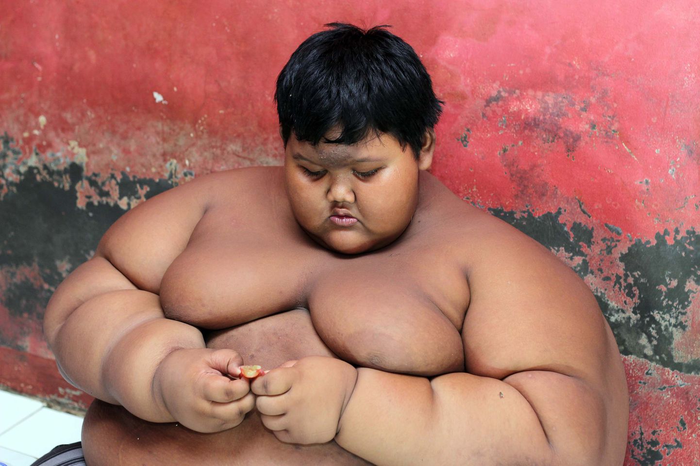 Арья Пермана, 12-летний мальчик из Индонезии, который весил более 190 кг, сбросил больше половины веса.