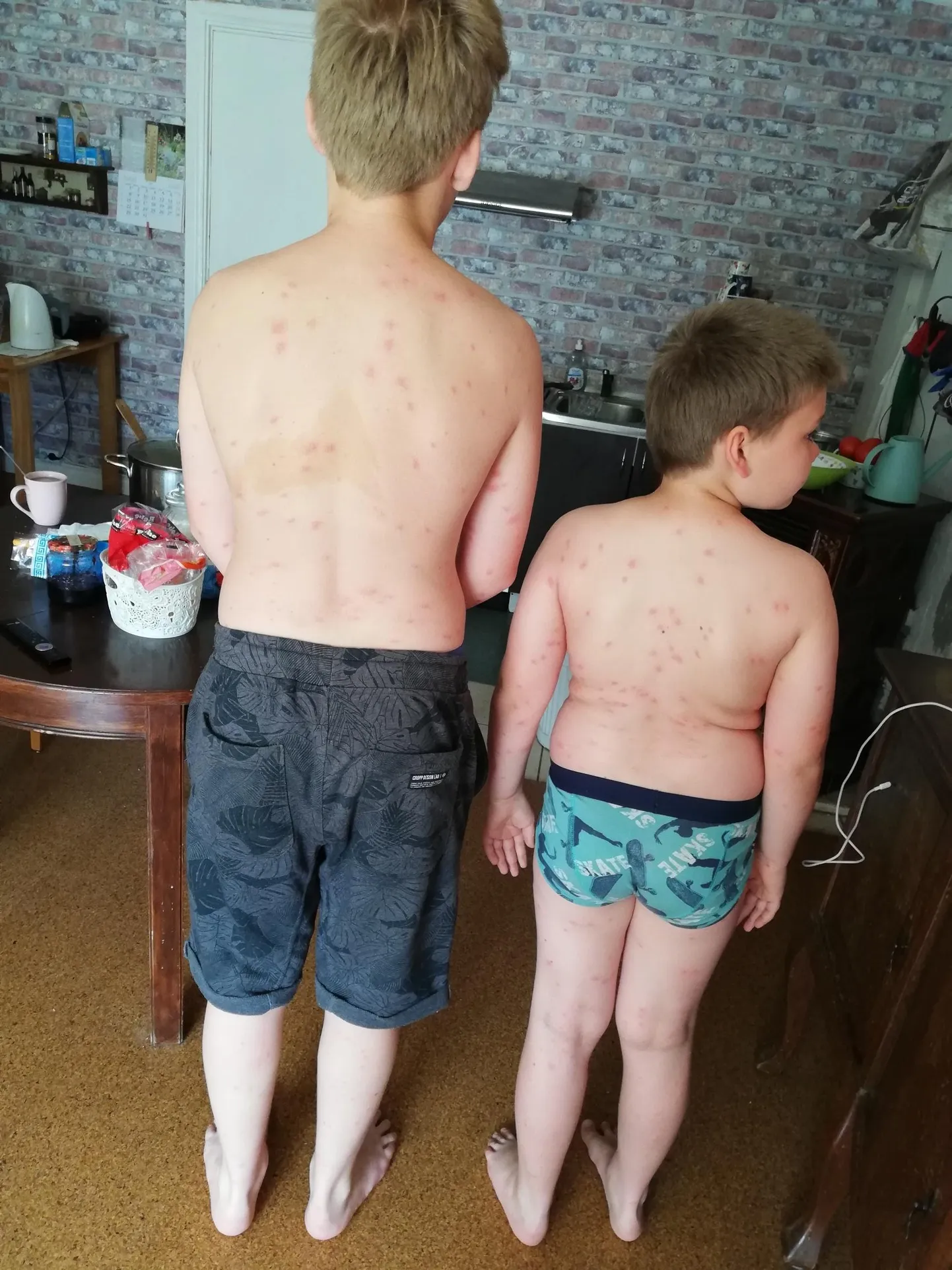 Lääneranna vallas Koonga lähistel Pikaveres Saari tiigis ujumas käinud poistel tekkisid pärast suplust nahale mädased punnid.