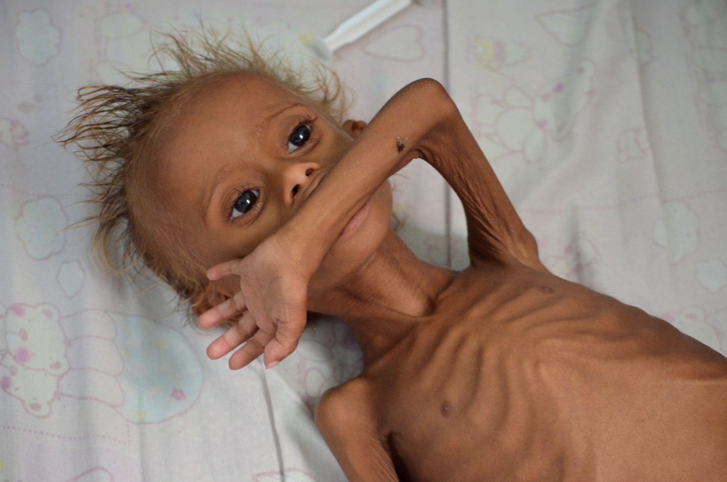 Näljas Jeemeni lapsed