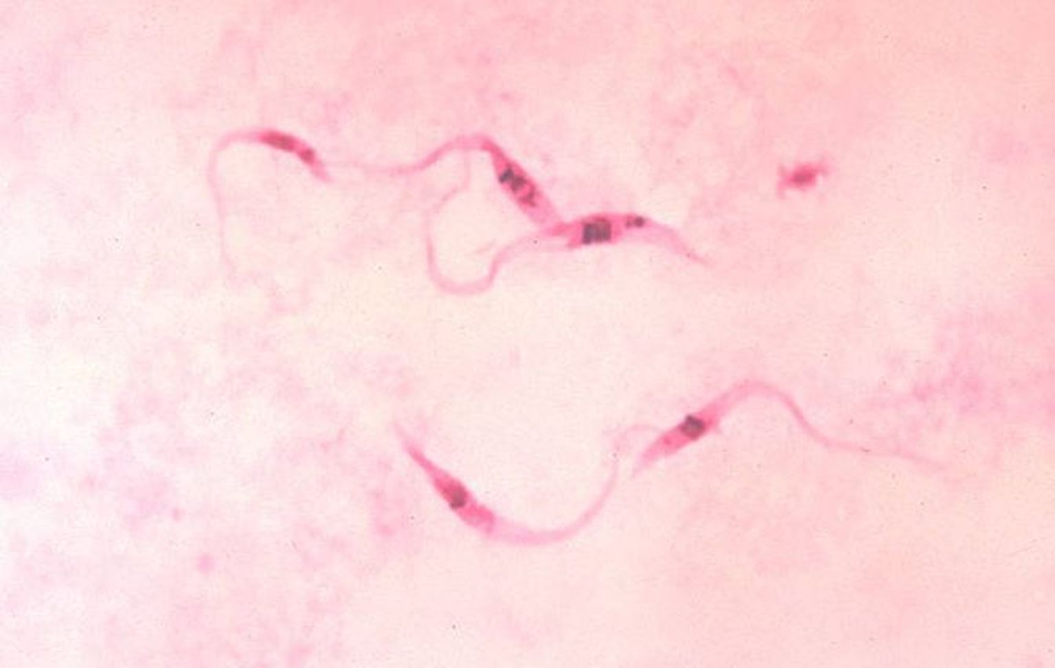 Parasiit Trypanosoma cruzi