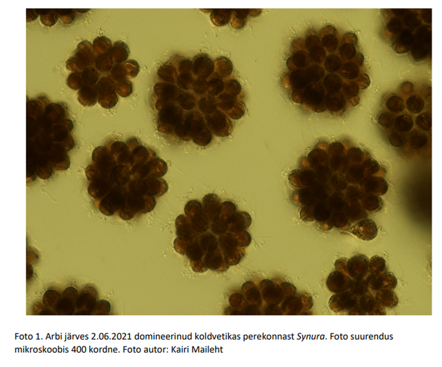 Arbi järvest leitud koldvetikas Synura perekonnast. Fotol mikroskoobis 400-kordselt suurendatud vetikas.