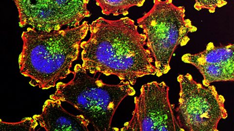 Kvantbiosensor – sellega näeb rakkudes toimuvaid nanotasandi muutusi