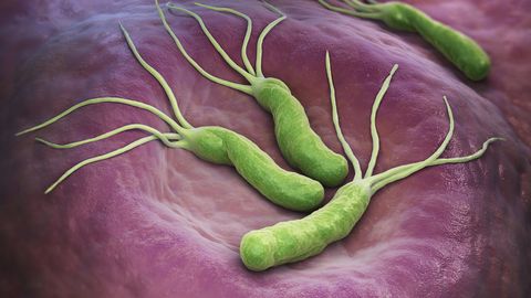 Helicobacter pylori Helicobacter pylori
