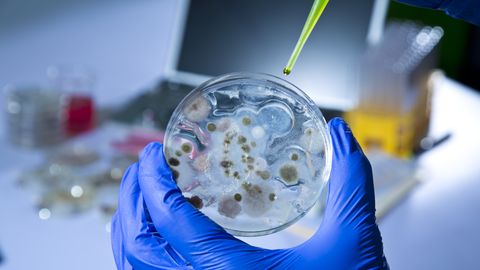 PVO: Kongo DR strauji izplatās Ebolas uzliesmojums