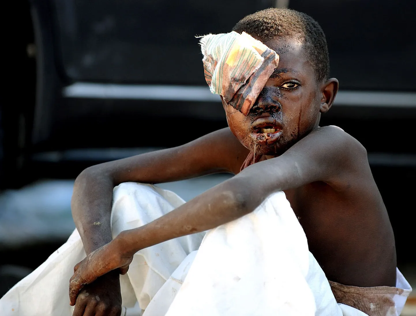 Haiti pealinnas Port-au-Prince´s kannatada saanud poiss.