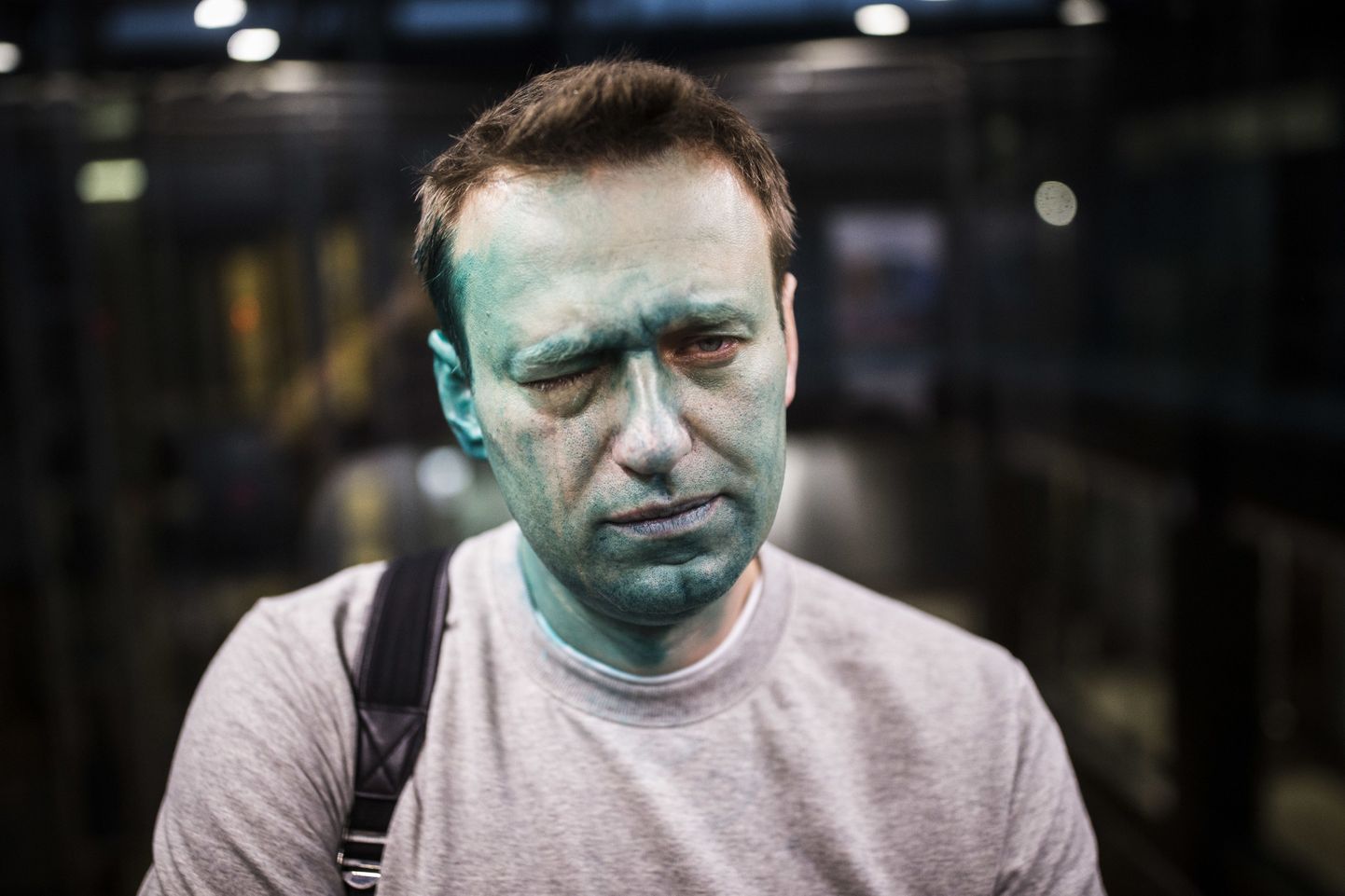 Vene opositsiooniaktivist Aleksei Navalnõi möödunud neljapäeval pärast briljantroheliserünnakut.