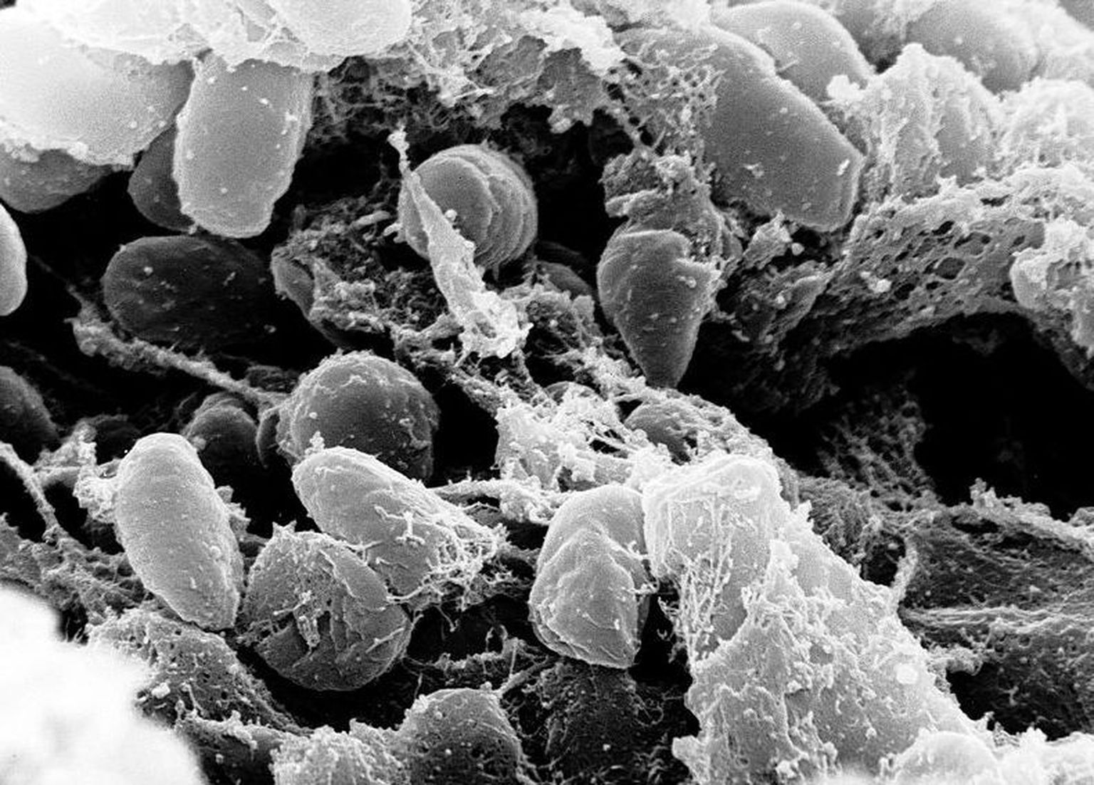 Katku põhjustav bakter Yersinia pestis