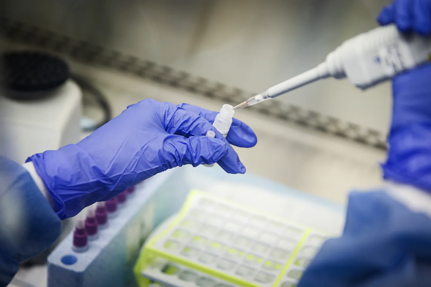 SARS-CoV-2 analüüsimine