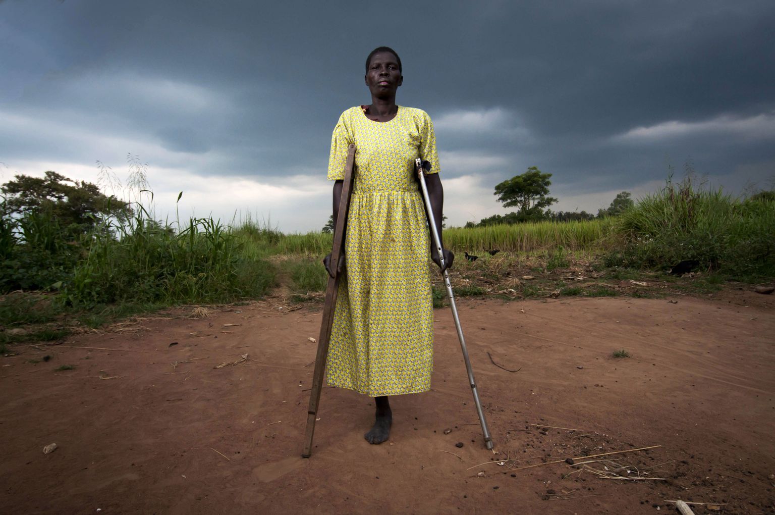 Praeguseks 50 aastat vana ugandalanna Filda Adoch kaotas maamiini otsas jala 14 aasta eest.