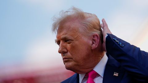 Šokeeriv paljastus: kas Trumpi kuulus soeng on tegelikult barbaarse operatsiooni tulemus
