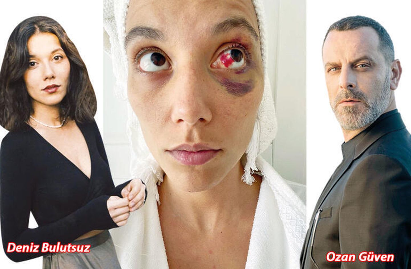 Дениз Булусуз пострадала от рук своего парня и актера Озана Гювена.