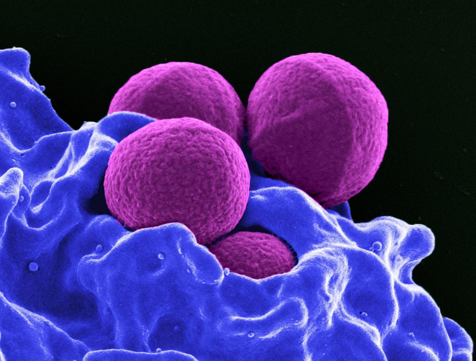 Valgelible (pildil küll sinine) õgimas antibiootikumiresitentsete Staphylococcus aureus&#39;e (MRSA – eetitsilliinresistentse stafülokoki) kogumit. Molekulaarste pintsettidega üksteisest lahutatult oleksid satfülokid olla antibiootikumidele või immuunsüsteemile oluliselt parem saak.