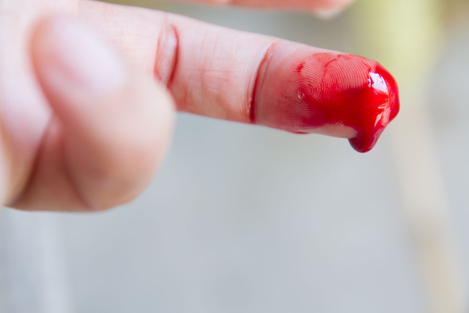 Verine sõrm. Pilt on illustreeriv