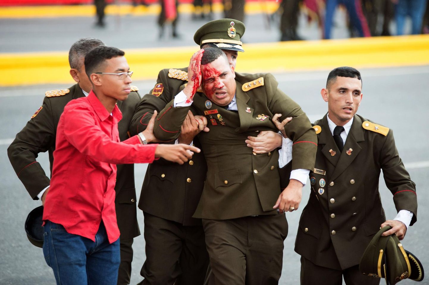 Vigastatud Venezuela julgeolekutöötaja riigi pealinnas Carcases pärast president Nicolas Madurole korraldatud väidetavat atentaati. FOTO: Chine Nouvelle/sipa/scanpix