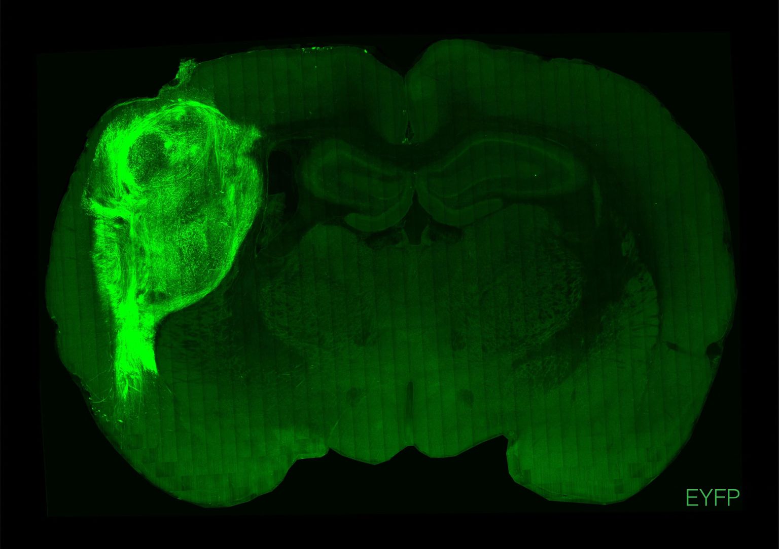Standfordi ülikooli  poolt 12. oktoobril avaldatud foto roti ajust. Helendavad laigud märgivad piirkonda, kuhu teadlased edukalt inimese närvirakud siirdasid.