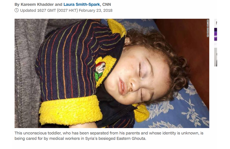 Väike poiss Ida-Ghouta haiglas.