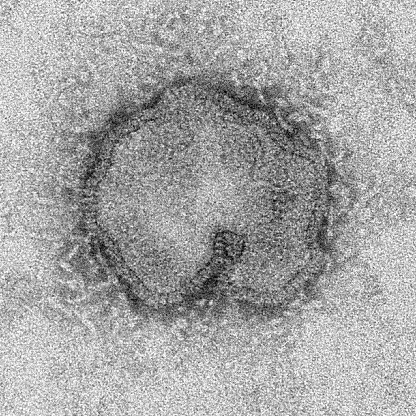 H7N9 viirus