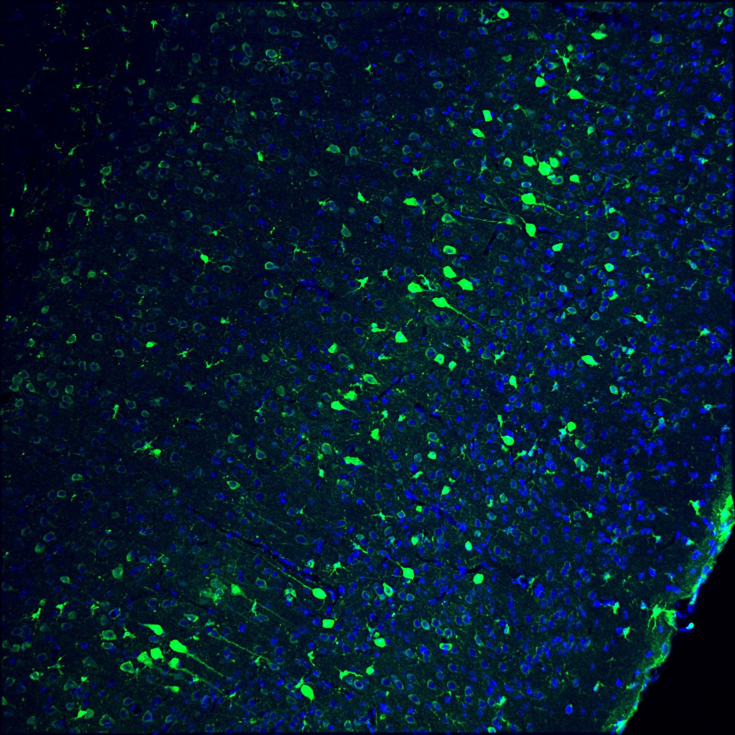 Täiskasvanud hiire aju proov. Sinisega on kujutatud rakutuumad ja rohelisega geenmuundatud neuronid.