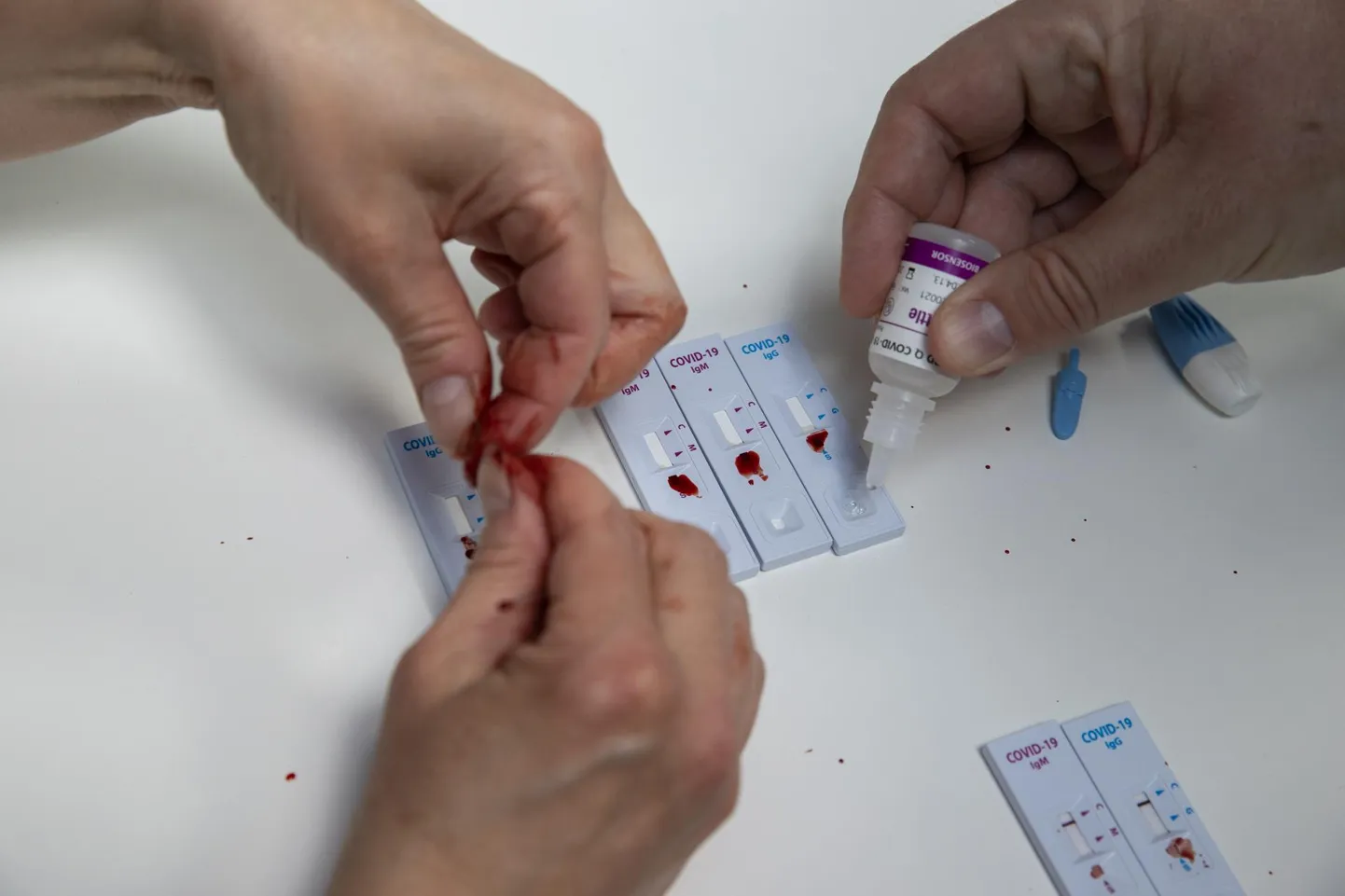 Koroonaviiruse antikehade test.