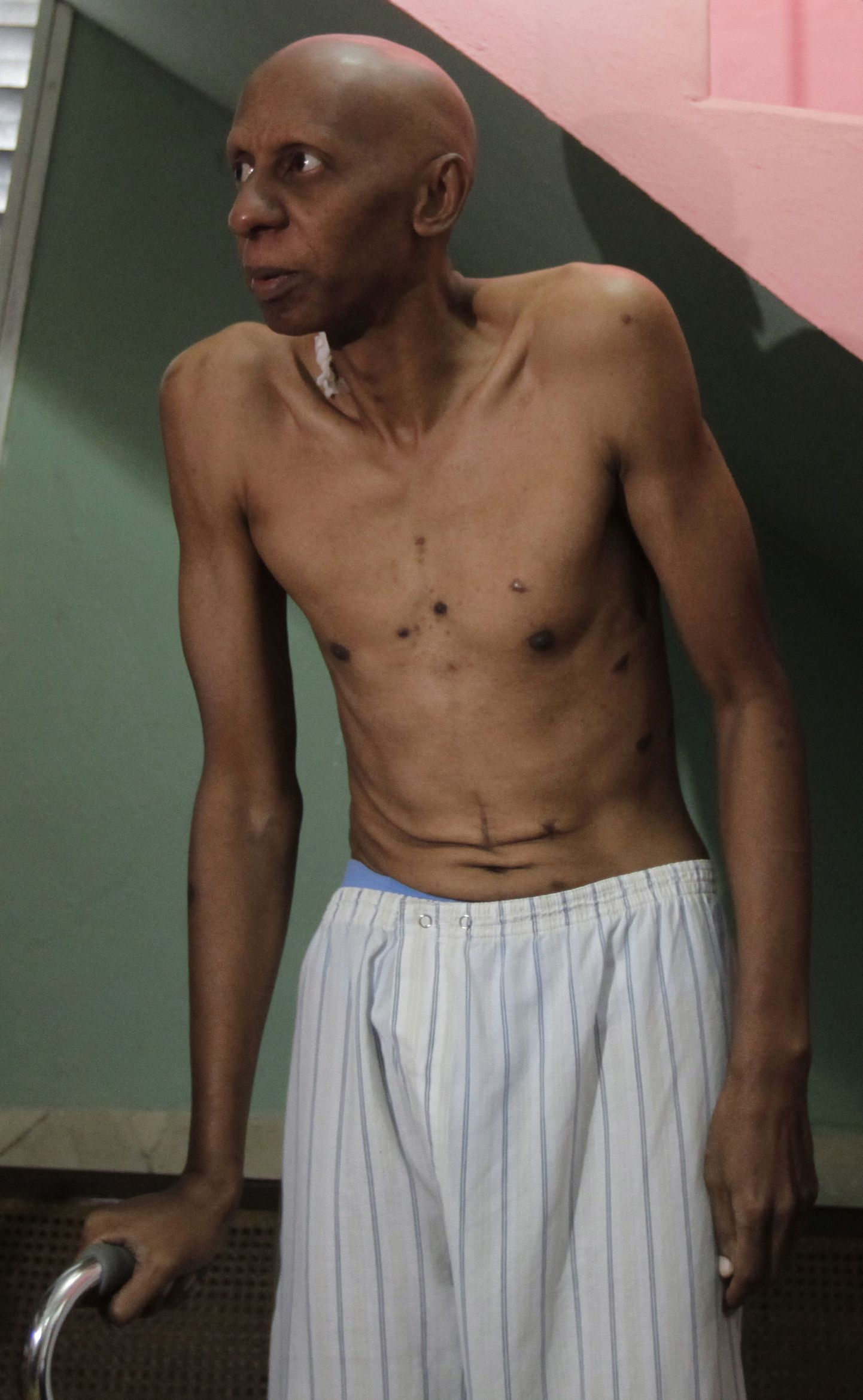Kuuba näljastreikija