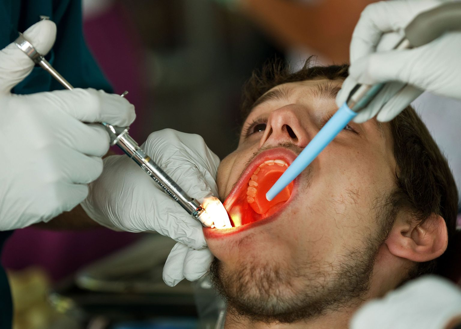 Hambaarst käskis tulevasel väimehel oma hambad korda teha