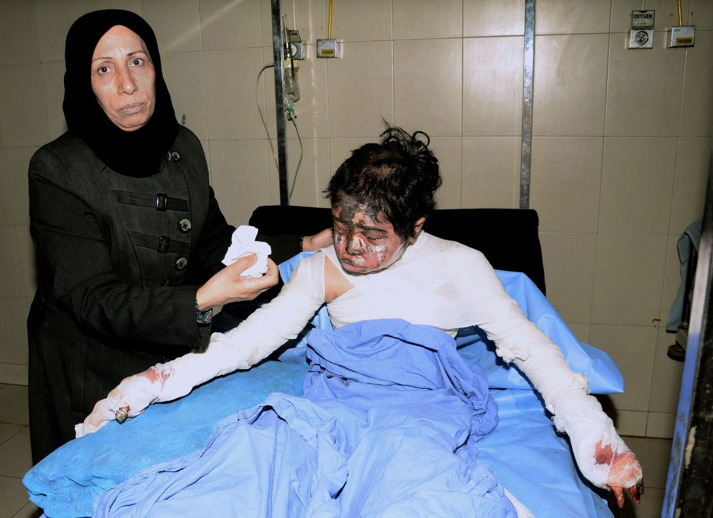 Süürlanna vigastatud lapse kõrval seismas.