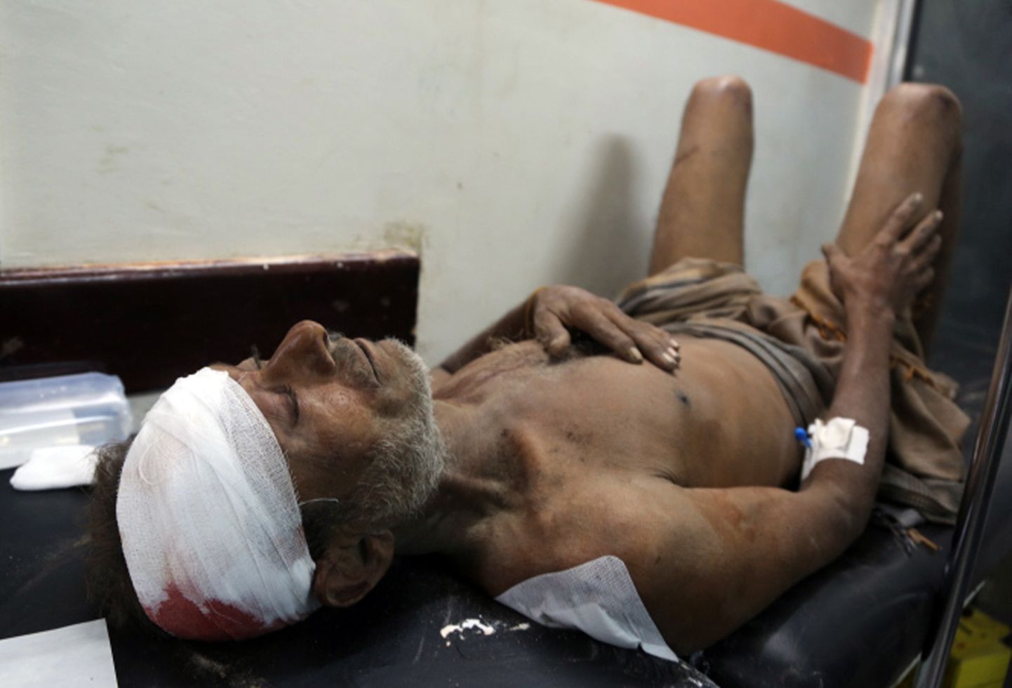 Haavatud jeemenlane haiglas lamamas.