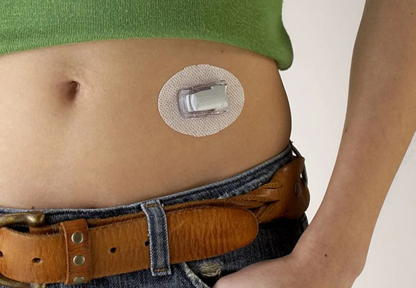 Bostoni ülikooli teadlased töötasid välja kunstpankrease, mis aitab kontrollida diabeedi tagajärjel tekkivaid muutusi hormoonide tasemes.