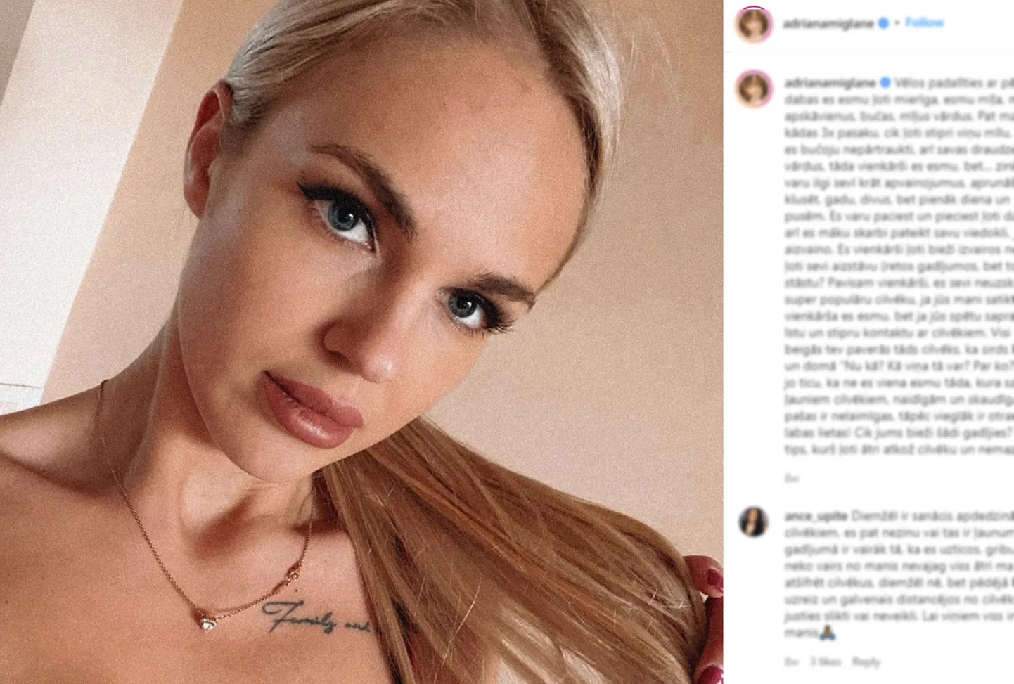 Raksta foto
