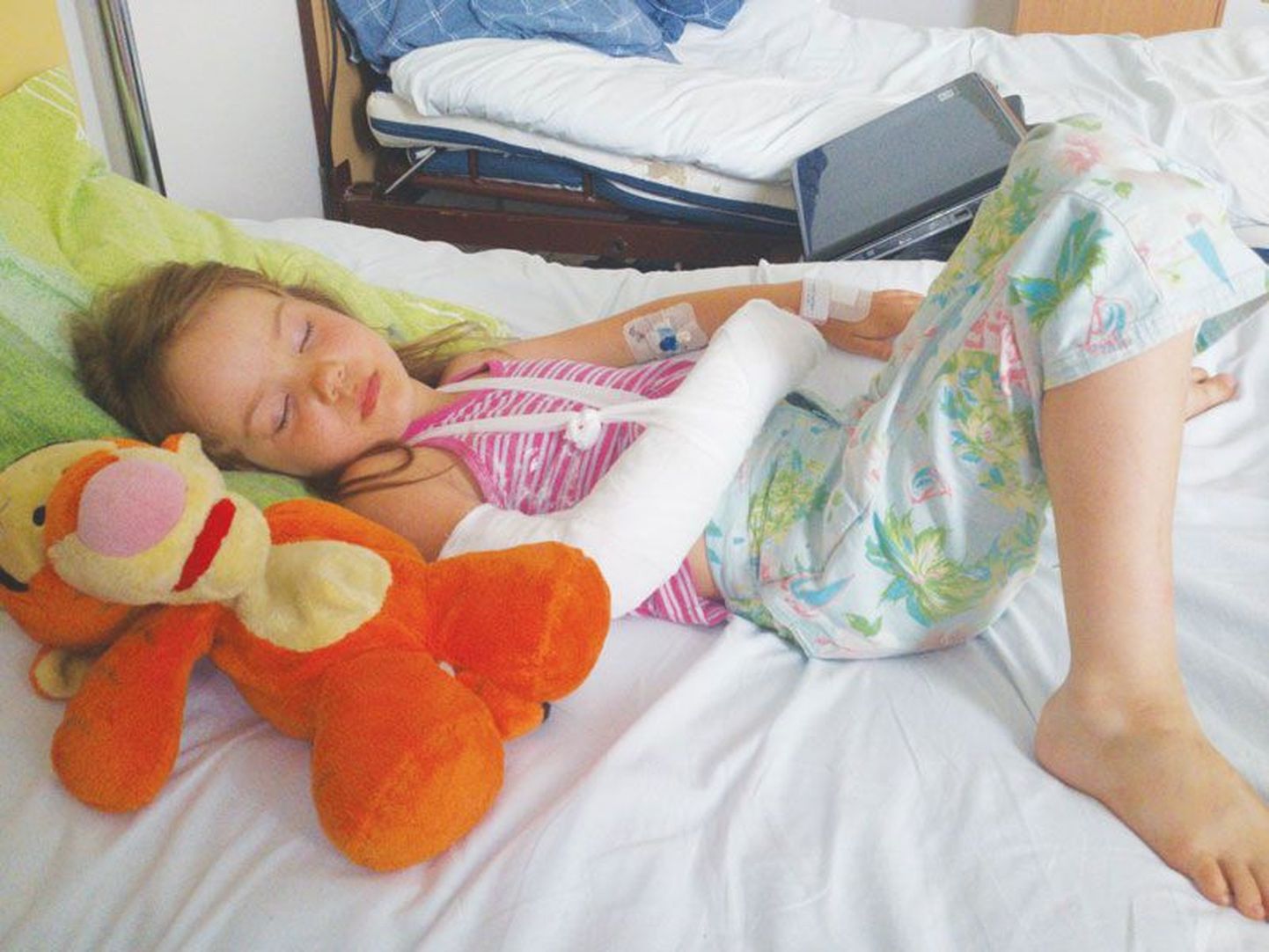 Шестилетная Леонсия Зубкова после операции в Нарвской больнице до ампутации.