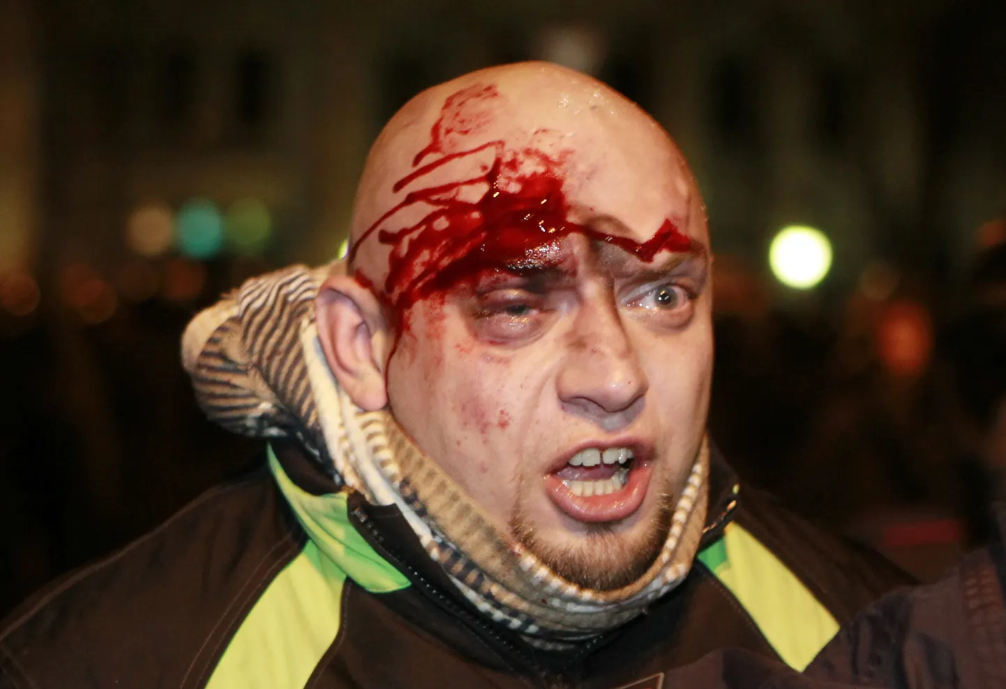 Kokkupõrgetes Kiievis on saanud viga meeleavaldajaid (näiteks see mees) ja enam kui sada märulimiilitsat.
