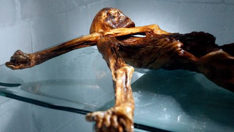 Ötzi ei ole sugugi surnud: iidne jäämees peidab endas üllatavalt elava mikroobimaailma