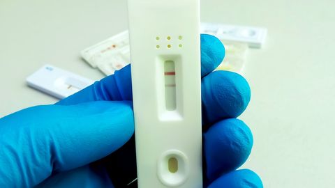 HIV-testimisnädal kutsub inimesi tasuta testima ja tervisest hoolima