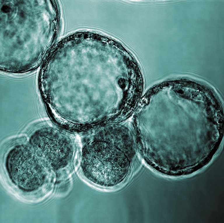 Mikroskoobipilt veise koorunud blastotsüstidest ehk lootepõiekestest.