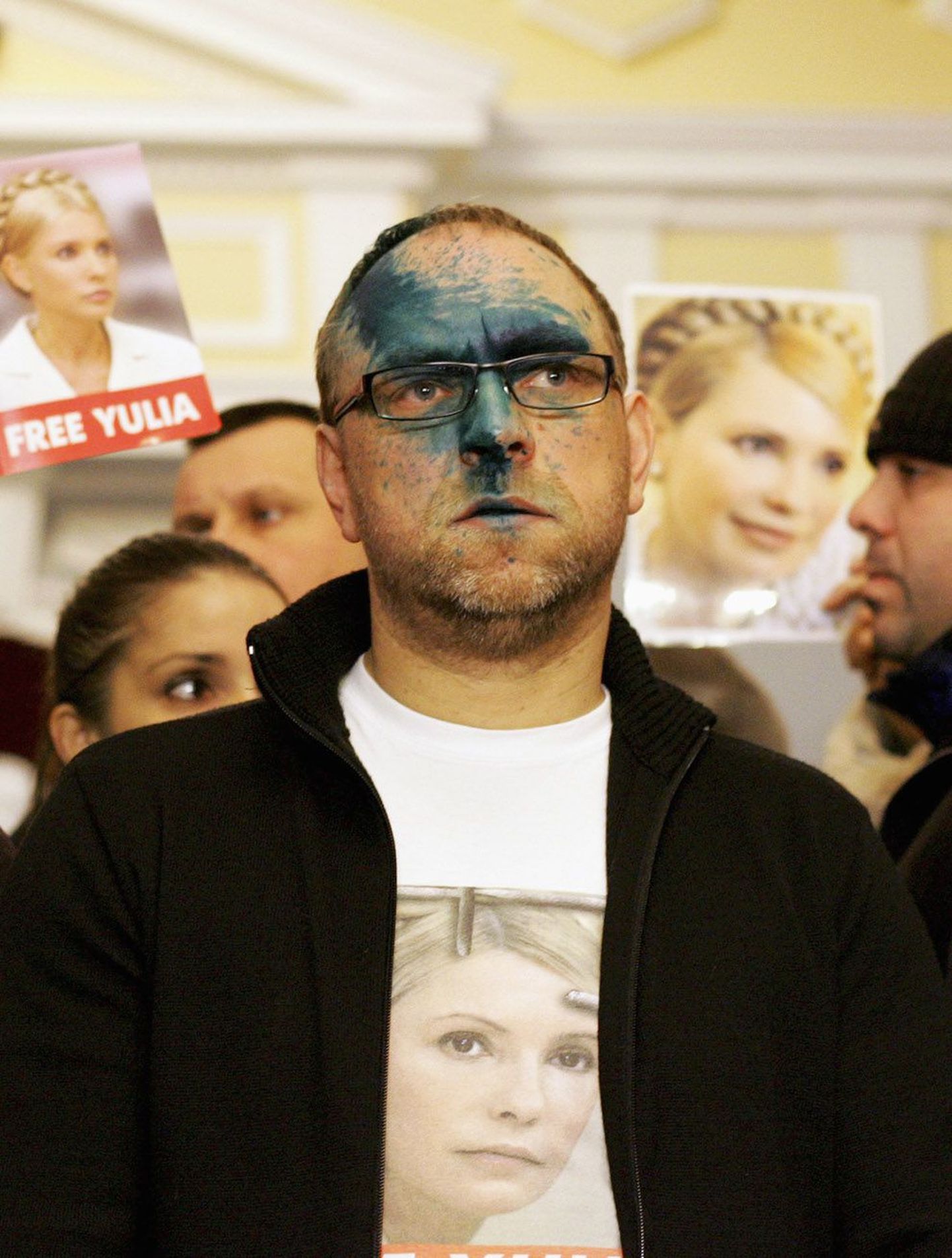 Julia Tõmošenko advokaati Serhi Vlassenkot tabas möödunud detsembris Harkivi istungi eel tundmatute kurjategijate korraldatud briljantrohelise rünnak.