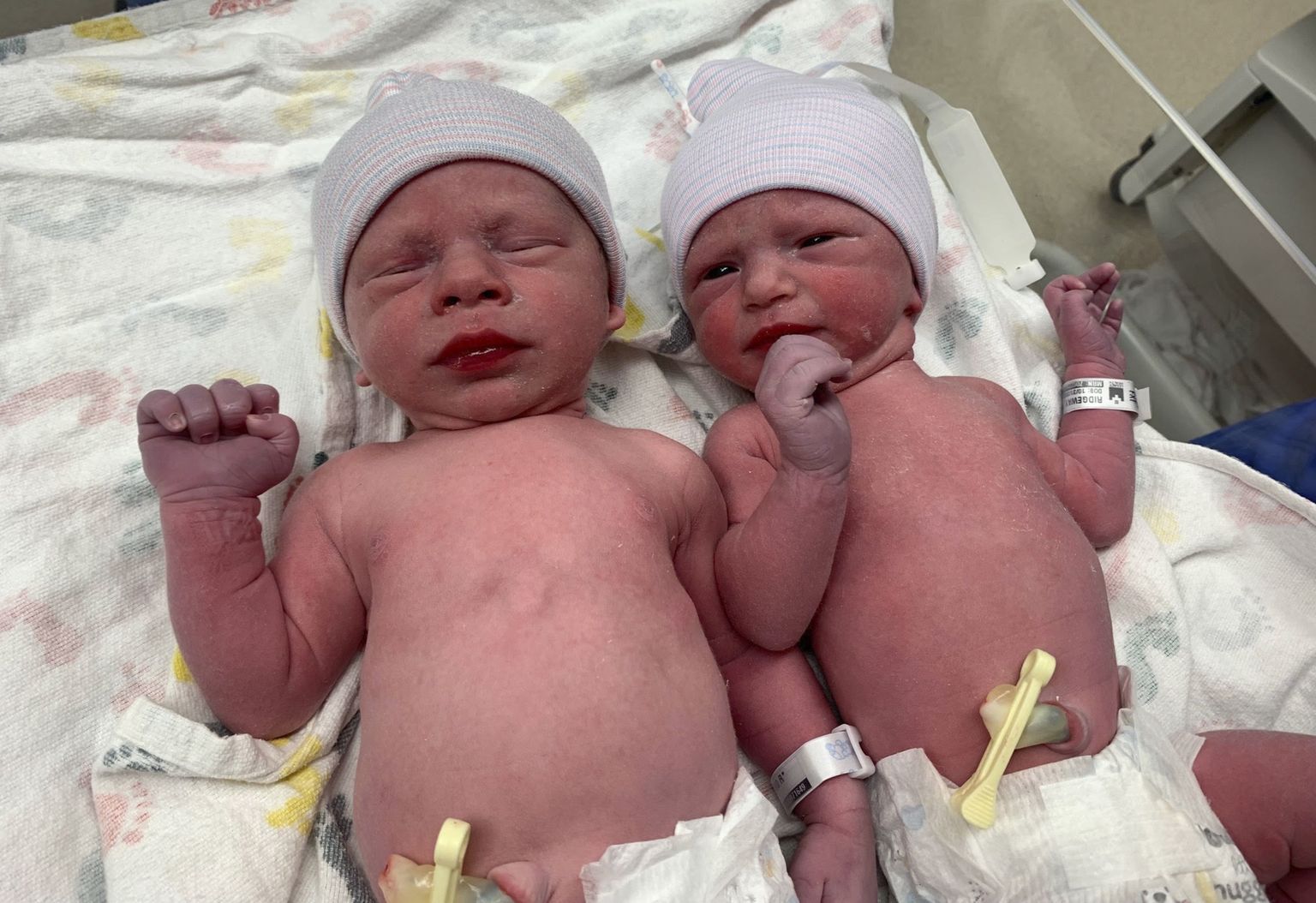 Maailma vanimatest embrüotest sündinud kaksikud on täies tervise juures.