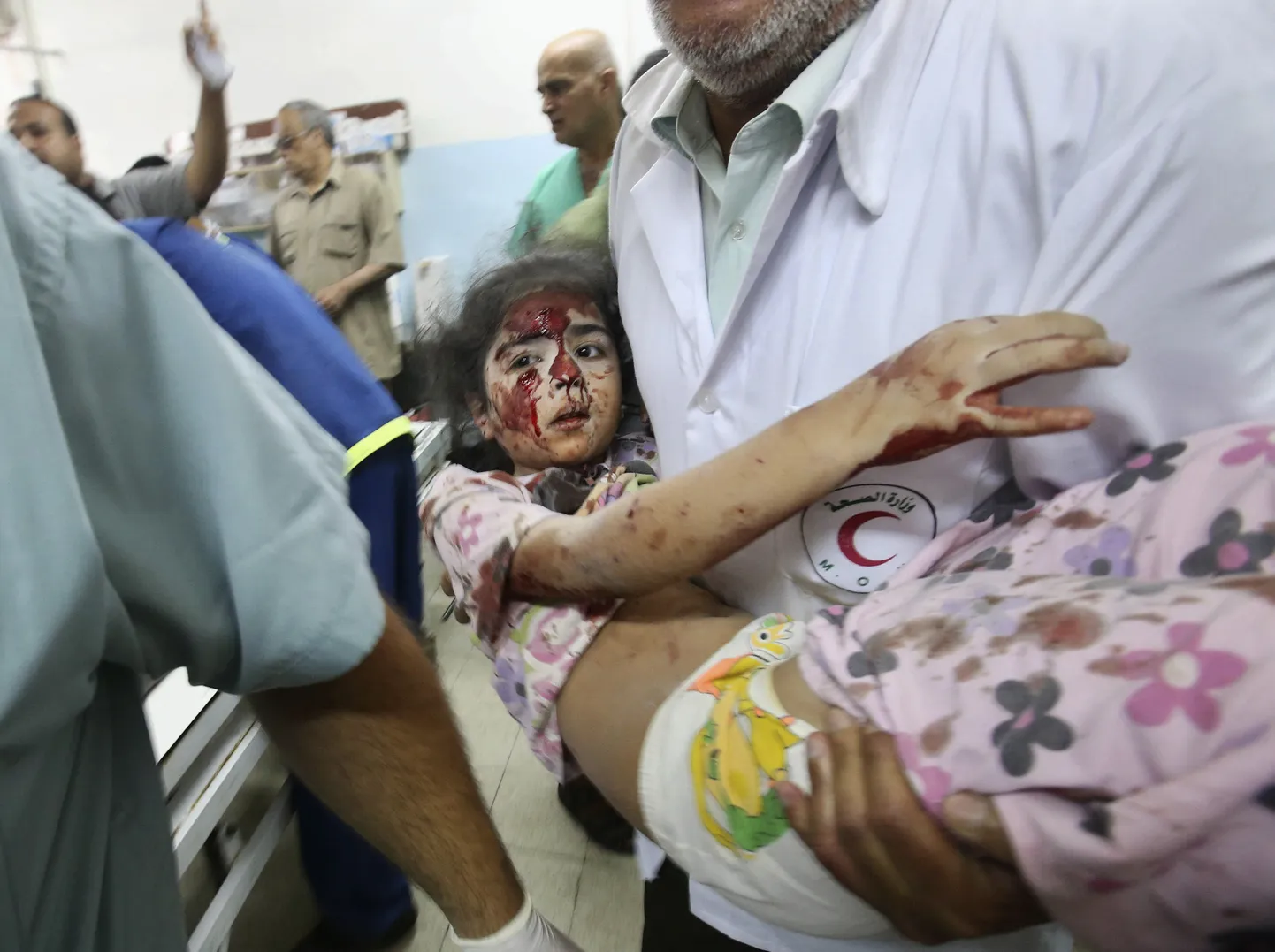 Gazasse tehtud õhurünnakus kannatada saanud laps